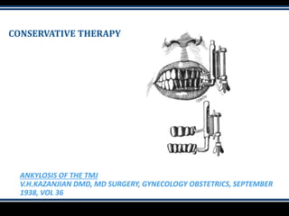 CONSERVATIVE THERAPY
ANKYLOSIS OF THE TMJ
V.H.KAZANJIAN DMD, MD SURGERY, GYNECOLOGY OBSTETRICS, SEPTEMBER
1938, VOL 36
 