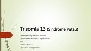 Trisomía 13 (Sindrome Patau)
González Rodríguez Josué Antonio
Universidad Autónoma de Baja California
466
Genética Medica
Dra. Falcon Noriega Leticia
 