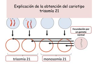 Explicación de la obtención del cariotipo trisomía 21 Fecundación por un gameto normal trisomía 21 monosomía 21 21 21 21 21 21 21 21 21 21 21 21 21 21