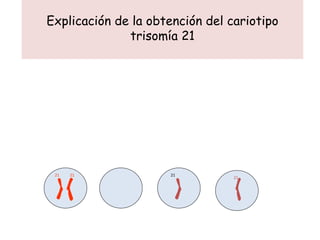 Explicación de la obtención del cariotipo trisomía 21 21 21 21 21