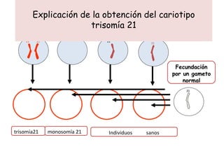 Explicación de la obtención del cariotipo trisomía 21 Individuos sanos trisomía21 monosomía 21 Fecundación por un gameto normal 21 21 21 21 21 21 21 21 21 21 21 21 21