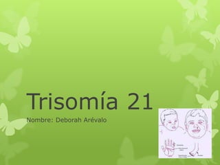 Trisomía 21
Nombre: Deborah Arévalo
 