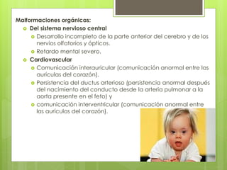 Malformaciones orgánicas: 
 Del sistema nervioso central 
 Desarrollo incompleto de la parte anterior del cerebro y de los 
nervios olfatorios y ópticos. 
 Retardo mental severo. 
 Cardiovascular 
 Comunicación interauricular (comunicación anormal entre las 
aurículas del corazón). 
 Persistencia del ductus arterioso (persistencia anormal después 
del nacimiento del conducto desde la arteria pulmonar a la 
aorta presente en el feto) y 
 comunicación interventricular (comunicación anormal entre 
las aurículas del corazón). 
 