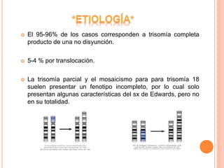  El 95-96% de los casos corresponden a trisomía completa
producto de una no disyunción.
 5-4 % por translocación.
 La trisomía parcial y el mosaicismo para para trisomía 18
suelen presentar un fenotipo incompleto, por lo cual solo
presentan algunas características del sx de Edwards, pero no
en su totalidad.
 