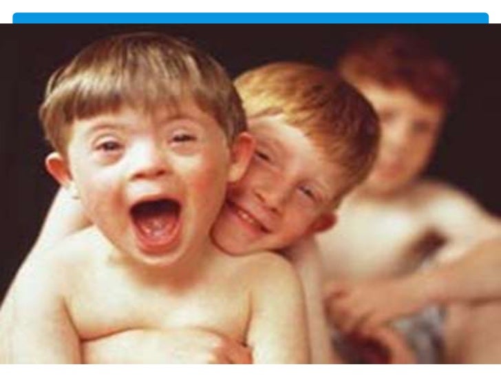 sindrome de trisomia sindrome de trisomia