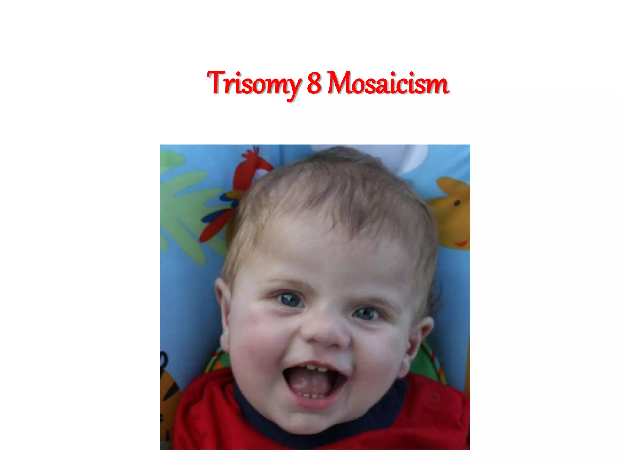Trisomy 8 Mosaicism
 