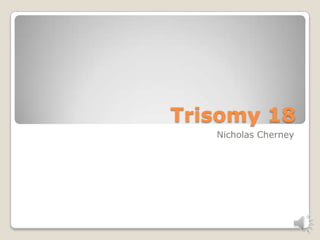 Trisomy 18
   Nicholas Cherney
 