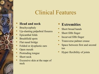 Clinical Features
 Head and neck
 Brachycephaly
 Up-slanting palpebral fissures
 Epicanthal folds
 Brushfield spots
 Flat nasal bridge
 Folded or dysplastic ears
 Open mouth
 Protruding tongue
 Short neck
 Excessive skin at the nape of
neck
 Extremities
 Short broad hands
 Short fifth finger
 Incurved fifth finger
 Transverse palmer crease
 Space between first and second
toe
 Hyper flexibility of joints
 