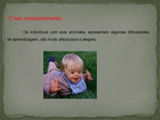 Relação idade/desenvolvimento da trissomia 21Depois dos 35 anos 9 : 1000 Antes dos 35 anos 1 : 1000 