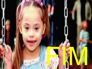 Tônus muscular e hérnias; 