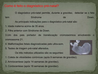 Quais as causas que desenvolvem esta anomalia? Existe algumas causas que provocam o desenvolvimento desta anomalia, que são as seguintes:   As crianças com Trissomia 21 apresentam um cromossoma a mais no par 21, formando um trio de cromossomas, daí a denominação utilizada;    