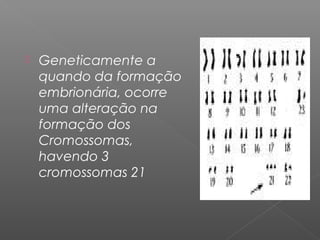    Geneticamente a
    quando da formação
    embrionária, ocorre
    uma alteração na
    formação dos
    Cromossomas,
    havendo 3
    cromossomas 21
 