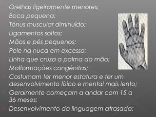    Orelhas ligeiramente menores;
   Boca pequena;
   Tónus muscular diminuído;
   Ligamentos soltos;
   Mãos e pés pequenos;
   Pele na nuca em excesso;
   Linha que cruza a palma da mão;
   Malformações congénitas;
   Costumam ter menor estatura e ter um
    desenvolvimento físico e mental mais lento;
   Geralmente começam a andar com 15 a
    36 meses;
   Desenvolvimento da linguagem atrasada;
 