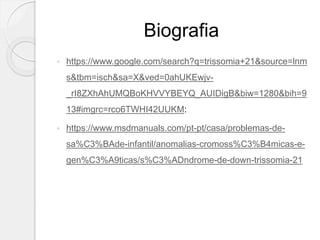 Biografia
 https://www.google.com/search?q=trissomia+21&source=lnm
s&tbm=isch&sa=X&ved=0ahUKEwjv-
_rI8ZXhAhUMQBoKHVVYBEYQ_AUIDigB&biw=1280&bih=9
13#imgrc=rco6TWHI42UUKM:
 https://www.msdmanuals.com/pt-pt/casa/problemas-de-
sa%C3%BAde-infantil/anomalias-cromoss%C3%B4micas-e-
gen%C3%A9ticas/s%C3%ADndrome-de-down-trissomia-21
 