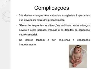Complicações
 3% destas crianças têm cataratas congénitas importantes
que devem ser extraídas precocemente.
 São muito frequentes as alterações auditivas nestas crianças
devido a otites serosas crónicas e os defeitos da condução
neuro sensorial.
 Os dentes tendem a ser pequenos e espaçados
irregularmente.
 