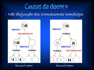Trissomia21