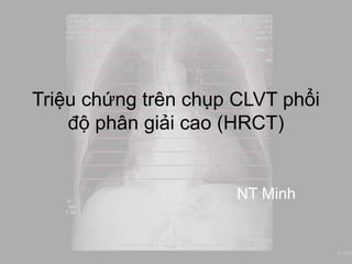 Triệu chứng trên chụp CLVT phổi 
độ phân giải cao (HRCT) 
http://www.radiologyassistant.nl 
NT Minh 
 