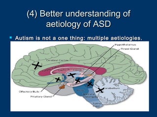 (4) Better understanding of(4) Better understanding of
aetiology of ASDaetiology of ASD
 Autism is not a one thing: multiple aetiologies.Autism is not a one thing: multiple aetiologies.
 