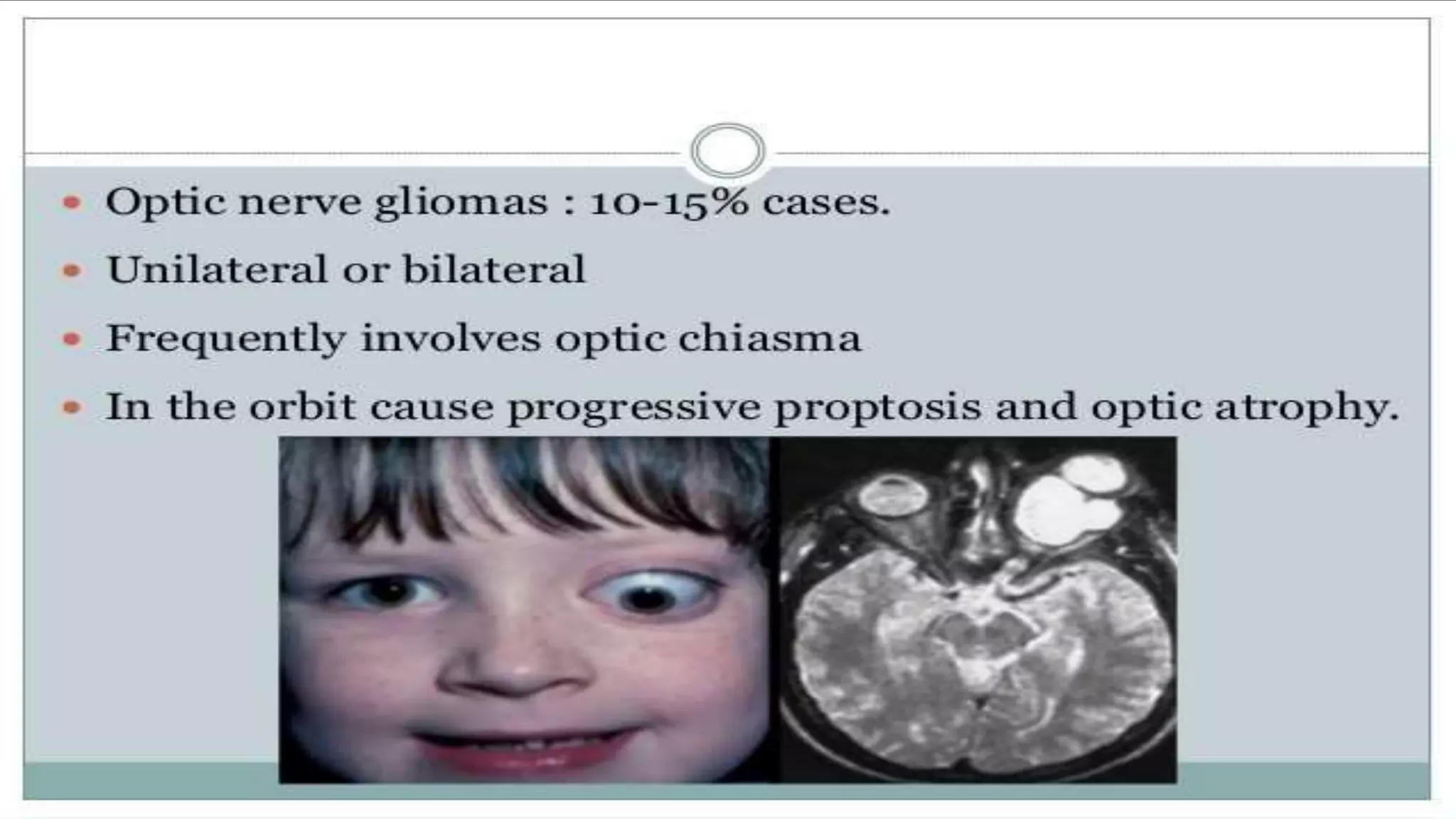 Ophthalmology Trivia - Feb 2020