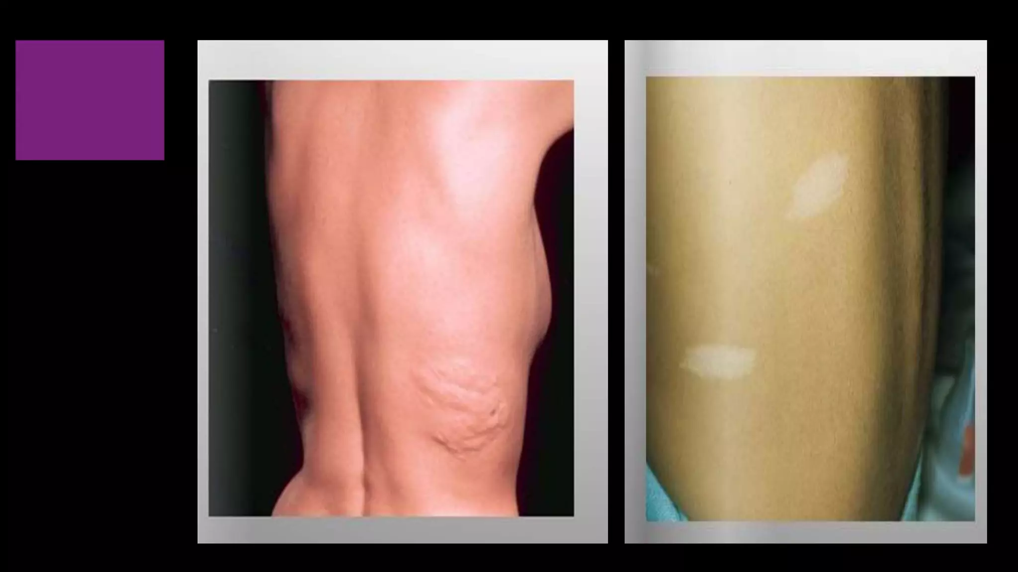 Ophthalmology Trivia - Feb 2020