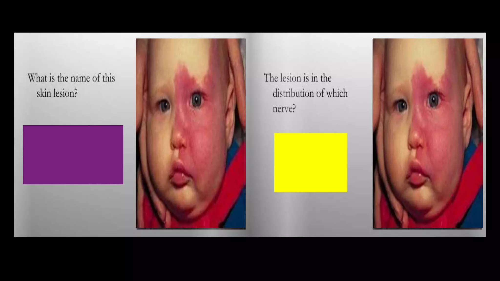 Ophthalmology Trivia - Feb 2020