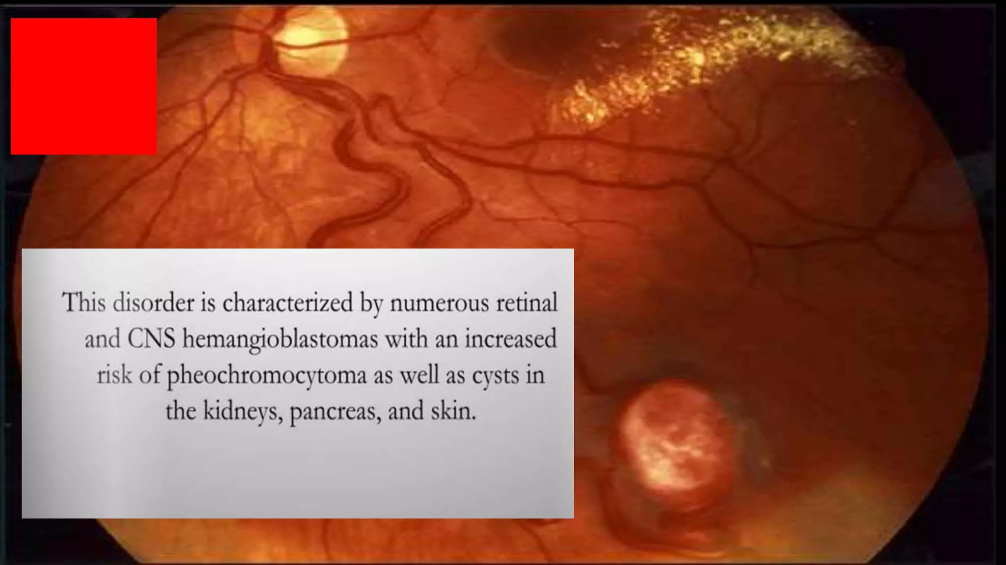 Ophthalmology Trivia - Feb 2020