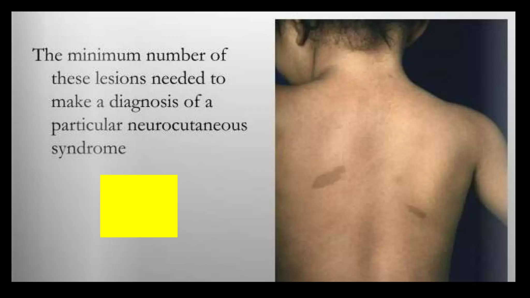 Ophthalmology Trivia - Feb 2020
