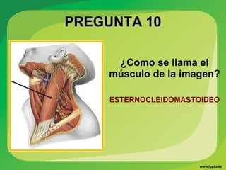 PREGUNTA 10PREGUNTA 10
¿Como se llama el
músculo de la imagen?
ESTERNOCLEIDOMASTOIDEO
 