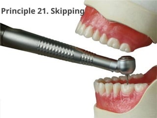 Principle 21. Skipping
 