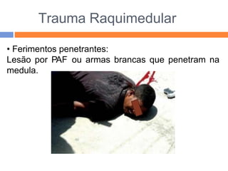 Trauma Raquimedular
• Ferimentos penetrantes:
Lesão por PAF ou armas brancas que penetram na
medula.
 