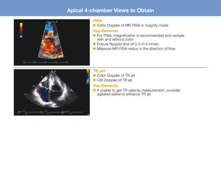 TTE Acquisition Guide | PDF