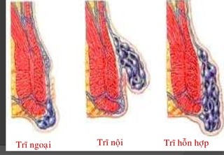 Taéc ngheõn heä thoáng tónh maïch