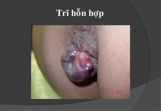 Caùcñaùmroáitónhmaïchtró