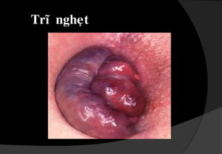 TróhoãnhôïpTrónoäiTróngoaïi