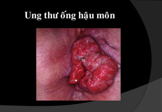 TRÓ NOÄISöïphìnhleânñaùmroáitónhmaïchtrótreân.