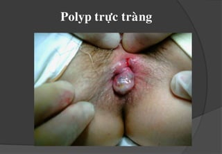 Ñoä 2 : sarakhiñicaàu, töïthuïtvaøoñöôïc.