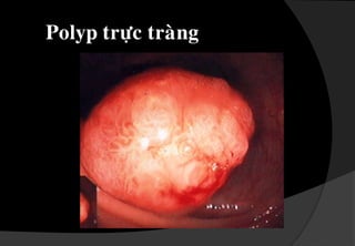 Ñoä 3 : sarakhiñicaàu,phaûiñaåymôùivaøo. 