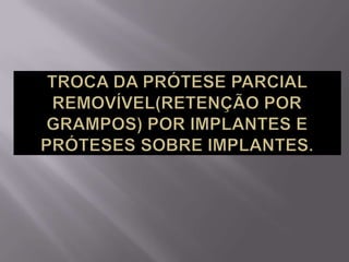 Troca da prótese parcial removível por implantes e próteses sobre implantes.
