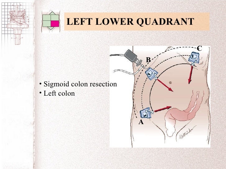 Cpt Code For Laparoscopic Colon Resection deltayudesign