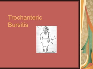 Trochanteric Bursitis 