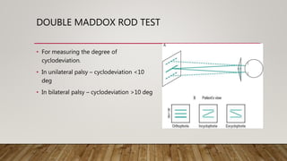 Three Rods Test Trochlear & Abducens Nerve | PPTX