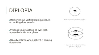 Trochlear and abducens nerve anatomy and applied | PPTX