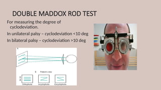 DOUBLE MADDOX ROD TEST
For measuring the degree of
cyclodeviation.
In unilateral palsy – cyclodeviation <10 deg
In bilateral palsy – cyclodeviation >10 deg
 