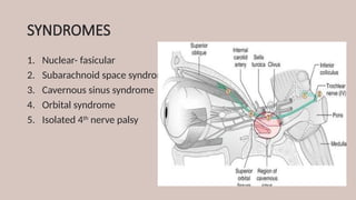 SYNDROMES
1. Nuclear- fasicular
2. Subarachnoid space syndrome
3. Cavernous sinus syndrome
4. Orbital syndrome
5. Isolated 4th
nerve palsy
 