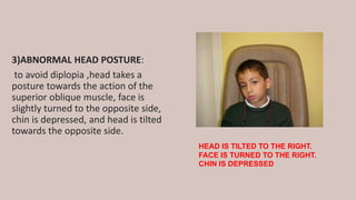 3)ABNORMAL HEAD POSTURE:
to avoid diplopia ,head takes a
posture towards the action of the
superior oblique muscle, face is
slightly turned to the opposite side,
chin is depressed, and head is tilted
towards the opposite side.
HEAD IS TILTED TO THE RIGHT.
FACE IS TURNED TO THE RIGHT.
CHIN IS DEPRESSED
 