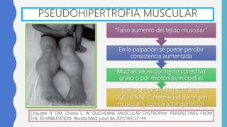 Ejm: PSEUDOHIPERTROFIA DE
DUCHENNE (Enfermedad de origen
muscular y con carácter genético)
Muchas veces por tejido conectivo
graso o por miotonías/miopatías
En la palpación se puede percibir
consistencia aumentada
“Falso aumento del tejido muscular”
Chaustre R. DM, Chona S. W. DUCHENNE MUSCULAR DYSTROPHY: PERSPECTIVES FROM
THE REHABILITATION. Revista Med. junio de 2011;19(1):37-44.
 