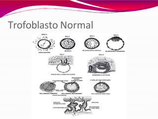 Trofoblasto Normal
 