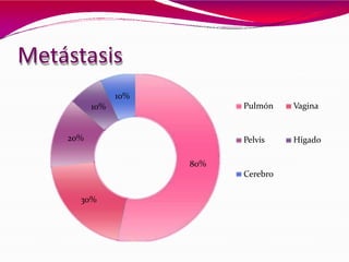 Metástasis
30%
20%
10%
10%
Pulmón Vagina
Pelvis Hígado
80%
Cerebro
 