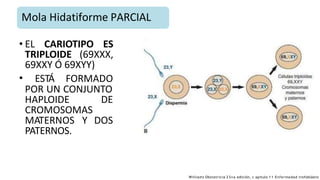 • EL CARIOTIPO ES
TRIPLOIDE (69XXX,
69XXY Ó 69XYY)
• ESTÁ FORMADO
POR UN CONJUNTO
HAPLOIDE DE
CROMOSOMAS
MATERNOS Y DOS
PATERNOS.
Mola Hidatiforme PARCIAL
Williams Obstetricia 2 3 v a edición, c apitulo 1 1 Enfermedad trofoblástic
 