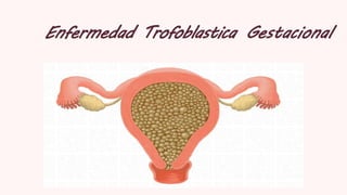 Enfermedad Trofoblastica Gestacional
 